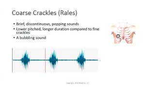 Coarse crackles Rales Lung Sounds [upl. by Esyned]