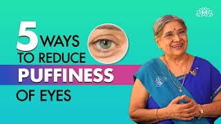 Home Remedies for Puffy Eyes I Treat puffy eyes naturally I Dr Hansaji [upl. by Benoite]