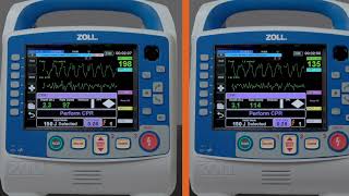 X Series® Advanced RapidShock™ Demonstration English [upl. by Gayn]