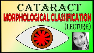 Morphological Classification of Cataract  Different Types of Cataract  Ophthalmology Lectures [upl. by Pain108]