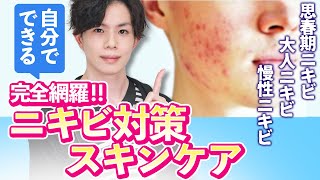 【ニキビ対策スキンケアまとめ】 思春期ニキビ・大人ニキビ・慢性ニキビ…それぞれの解決法を美容専門家が撤退解説！ [upl. by Sadnac]