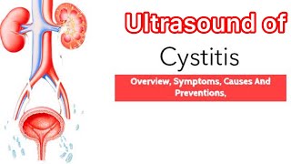 Treatment of Cystitis  Ultrasound of bladder cystitis  Medicine information  Medical knowledge [upl. by Congdon898]