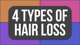 What type of hair loss are YOU experiencing [upl. by Hesper265]