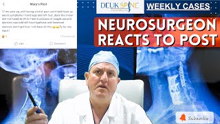 Neurosurgeon Reacts to Post [upl. by Zitah550]