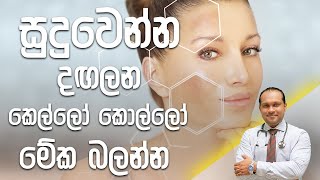 සුදුවෙන්න දඟලන කෙල්ලෝ කොල්ලෝ මේක බලන්න  Dr Namal Wijesinghe [upl. by Aynosal]