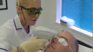 Eyebrow Laser Hair Removal Be Careful  CanovaMedicalcom [upl. by Akemad]