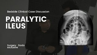 Paralytic Ileus  Presentation evaluation and management Clincalculable case discussion [upl. by Atsahc981]