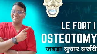 Dr Rudra Mohan  जबड़े के सुधार के लिए सर्जरी  Orthognathic Surgery  Le Fort I Osteotomy [upl. by Urbano]