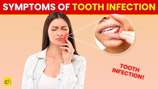 10 Symptoms of a Tooth Infection You Shouldnt Ignore  Credihealth toothpainrelief tooth [upl. by Haziza355]