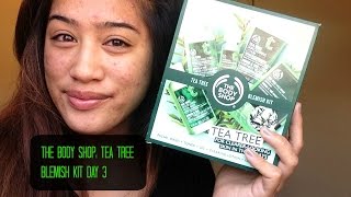 The Body Shop Tea Tree Blemish Kit Day 3 [upl. by Gnilsia336]