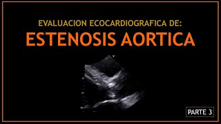 ESTENOSIS AORTICA Evaluacion ecocardiografica  PARTE 3 [upl. by Lunn]