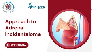 Approach to Adrenal Incidentaloma [upl. by Eintirb]