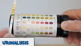 Urine Dipstick TestPrincipleProcedureResults [upl. by Enitsua]