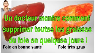 Un docteur montre comment supprimer toutes les graisses du foie en quelques jours [upl. by Shiff627]