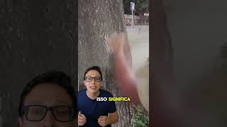 Ossos Fortes 🦴💪 medicina medico enfermagem saude curiosidademedicina curiosidades academia [upl. by Eirrek]