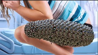 ASMR Removal trypophobia animation treatments Infected 🦵the wrist  ASMR animation LAST ASMR [upl. by Llewen]