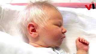 WhiteHaired Baby Surprises Doctors Until They Realize [upl. by Yelmene692]