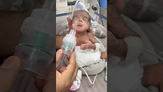 Extubation premature baby part4♥️good reflexes [upl. by Tamsky]