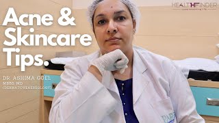 Acne Skin Care Tips by Dr Ashima Goel  Best Dermatologist In Chandigarh  HealthFinder [upl. by Granniah]