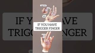 If you have Trigger Finger try these two exercises triggerfinger [upl. by Aynwad36]