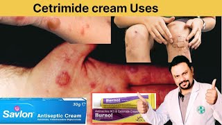 Uses of Cetrimide creamsavloncreamburnloncream [upl. by Ailb360]