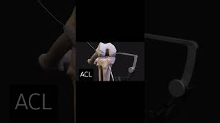 ACL Anterior Cruciate Ligamentsubscribe anatomy physioterapy kneepain exercise kneeexercise [upl. by Skylar]