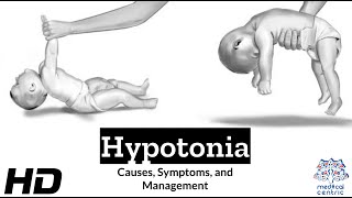 Hypotonia Explained What You Need to Know [upl. by Arihsay]