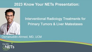 quotInterventional Radiology Treatments for Primary Tumors and Liver Metastasesquot Dr Osmanudddin Ahmed [upl. by Alys]