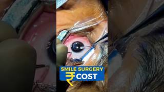 Smile Surgery Cost [upl. by Ahsenal]