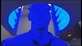 PHOTODYNAMIC THERAPY ”BLUE LIGHT” Im getting my face burned off [upl. by Asum]