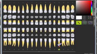 Odontograma actualizado [upl. by Naujid]