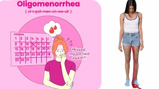 oligomenorrhea  oligomenorrhea causes [upl. by Manbahs]