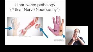 How to treat pain cold numbness in the pinky and ring finger  ulnar neuropathy cubital tunnel [upl. by Orford]