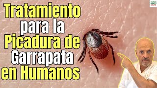 🚨 PICADURA DE GARRAPATA EN HUMANOS TRATAMIENTO MÁS EFECTIVO 🚨 [upl. by Hanah]