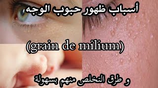 أسباب ظهور حبوب الوجه grain de milium وطرق التخلص منهم بسهولة [upl. by Ytomit538]