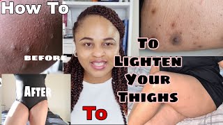 How To Lighten Dark Inner Thighs Fast and Effective Naturally [upl. by Marita]