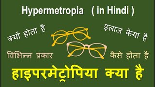 Hypermetropia causes types and treatment in Hindihypermetropia hyperopia longsightedness [upl. by Philippa921]