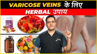 Best herbal medicines and care for varicose veins  Dr Gaurav Gangwani Interventional Radiologist [upl. by Ennairb203]