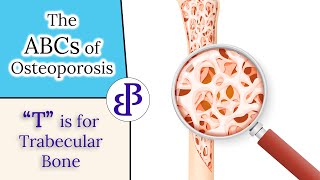 T is for Trabecular Bone  The ABCs of Osteoporosis [upl. by Mohorva553]