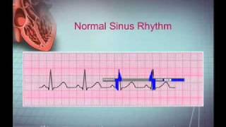 Intro EKG Interpretation Part 1 [upl. by Pyszka]