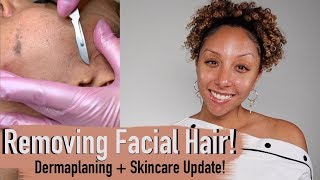 Removing Facial Hair Dermaplaning  Skincare Update  BiancaReneeToday [upl. by Page97]