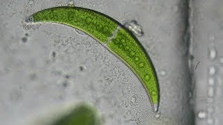 Crescent Shaped Algae Closterium moniliferum [upl. by Imis]