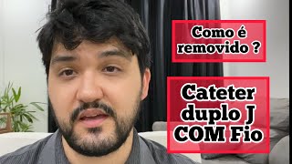 Cateter duplo J COM fio externo como é removido [upl. by Ramad]