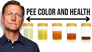 What Your URINE COLOR Says about Your Health [upl. by Akirdnahs]