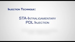 Module STA Intraligamentary Injection [upl. by Quintilla]