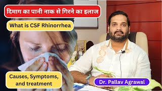 दिमाग का पानी नाक से गिरने का इलाज All about CSF Rhinorrhea  Causes Symptoms and treatment [upl. by Magee]