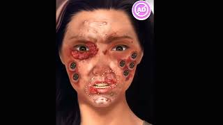 ASMR treatment for girl face mogot remove animation video [upl. by Cogan95]