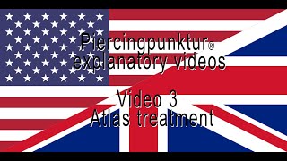 Video 3  Atlas treatment [upl. by Ultann]