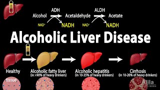 Alcoholic Liver Disease Animation [upl. by Mharg236]