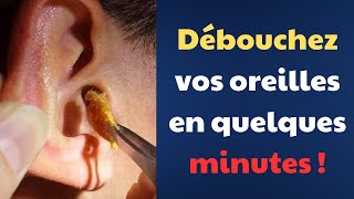 Oreille bouchée  causes et solutions efficaces Fact24h [upl. by Oigolue]